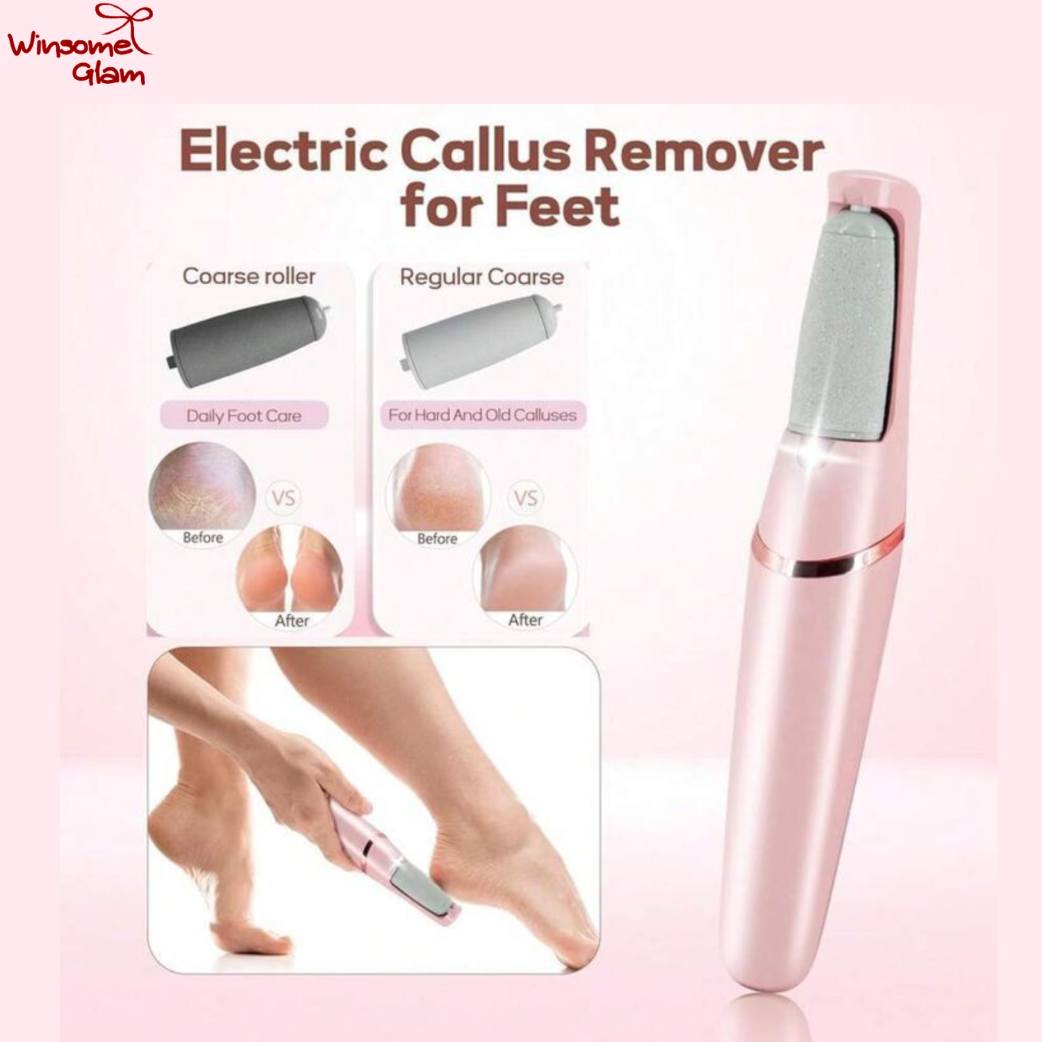 Electric Foot Callus Remover — thumbnail 3