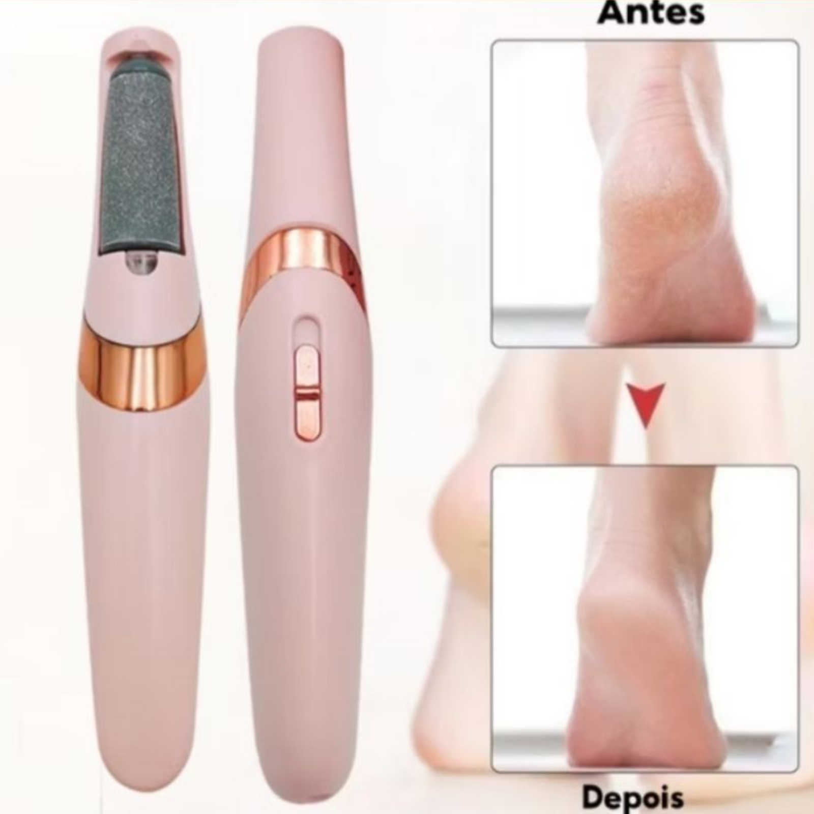 Electric Foot Callus Remover — thumbnail 4