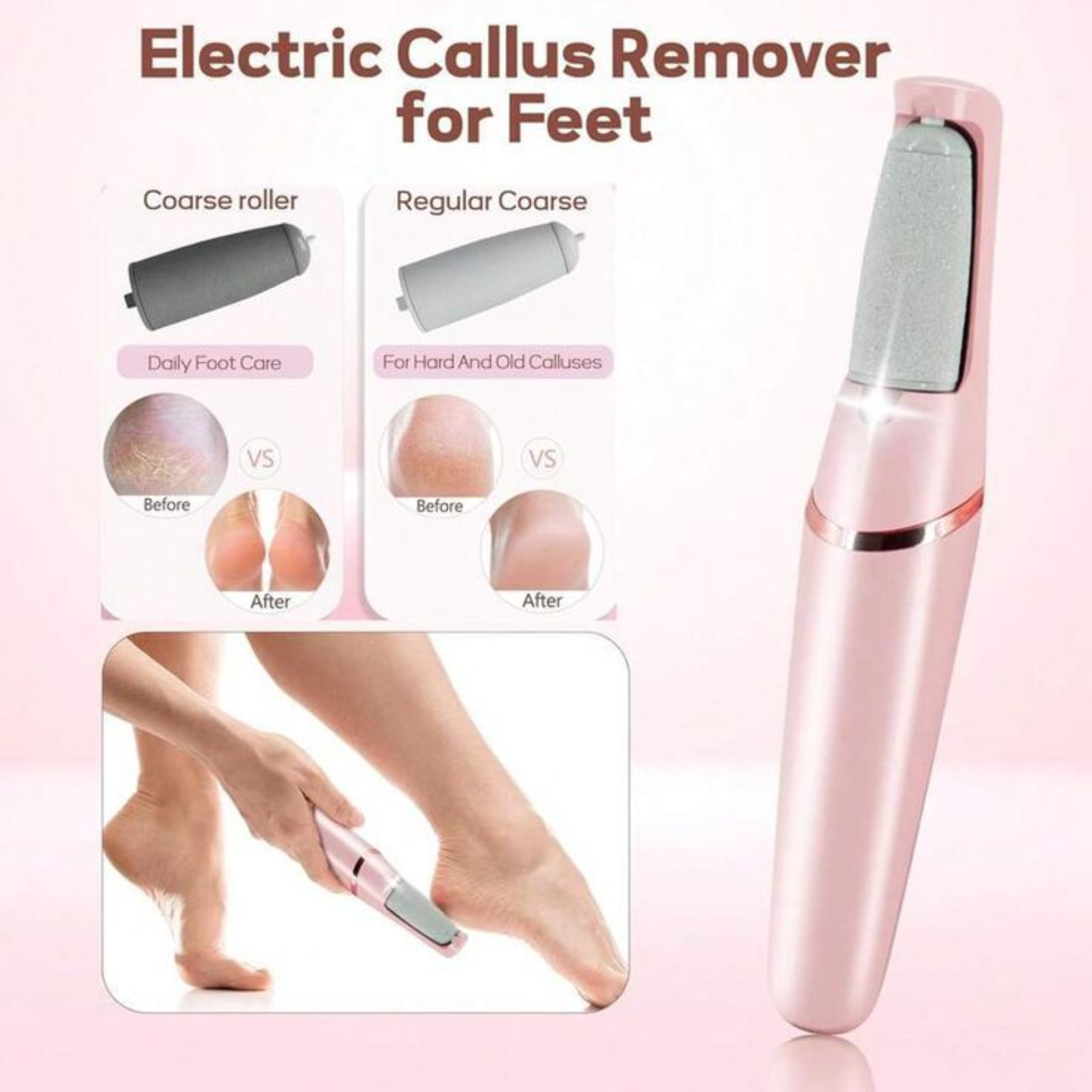 Electric Foot Callus Remover — thumbnail 2